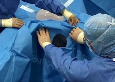 Χειρουργικό Laparoscopy Drape, αποστειρωμένο μίας χρήσης υπομονετικό Drapes με το μπλε χρώμα ETO